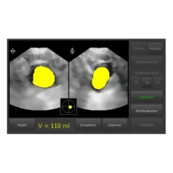 BLADDER SCANNER VITASCAN DP AVEC PIED IMPRIMANTE INTÉGRÉE VITACON - avec pied