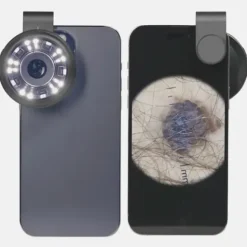DERMATOSCOPE DERMA MED20 POLARISÉ X10 POUR SMARTPHONE - avec adaptateur universel