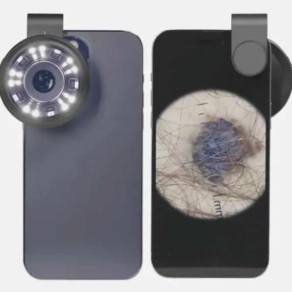 DERMATOSCOPE DERMA MED20 POLARISÉ X10 POUR SMARTPHONE - avec adaptateur universel