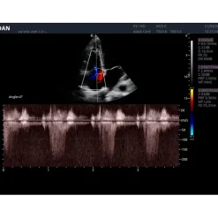 ECHOGRAPHE COULEUR 3D/4D ACLLRAIX LX8 DOPPLER COULEUR EDAN - avec 1 sonde