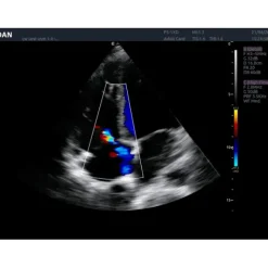 ECHOGRAPHE COULEUR 3D/4D ACLLRAIX LX8 DOPPLER COULEUR EDAN - avec 1 sonde