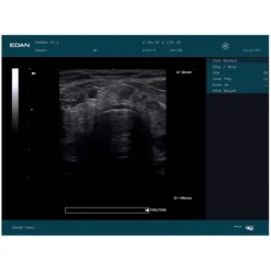 ECHOGRAPHE DUS60 PORTABLE DOPPLER PULSÉ EDAN - avec 1 sonde