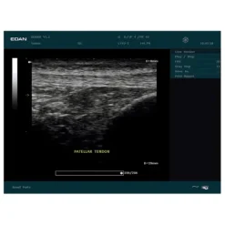 ECHOGRAPHE DUS60 PORTABLE DOPPLER PULSÉ EDAN - avec 1 sonde