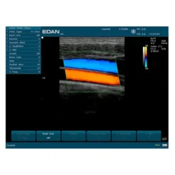 ECHOGRAPHE U50 IMAGERIE COULEUR AVEC 1 SONDE EDAN - avec 1 sonde