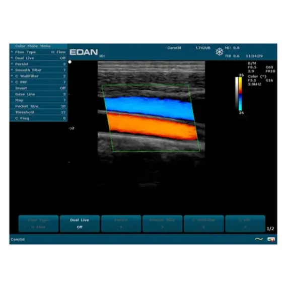 ECHOGRAPHE U50 IMAGERIE COULEUR AVEC 1 SONDE EDAN - avec 1 sonde