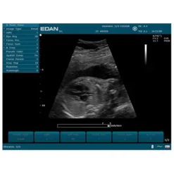 ECHOGRAPHE U50 IMAGERIE COULEUR AVEC 1 SONDE EDAN - avec 1 sonde