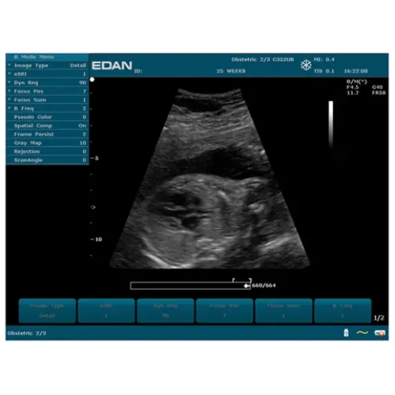 ECHOGRAPHE U50 IMAGERIE COULEUR AVEC 1 SONDE EDAN - avec 1 sonde
