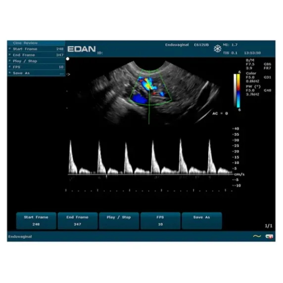 ECHOGRAPHE U50 IMAGERIE COULEUR AVEC 1 SONDE EDAN - avec 1 sonde