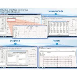 LOGICIEL ECG VIEWER SOFTWARE VE-300 GESTION DES DONNÉES GIMA - logiciel pc