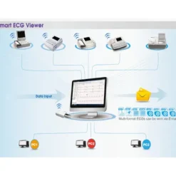 LOGICIEL ECG VIEWER SOFTWARE VE-300 GESTION DES DONNÉES GIMA - logiciel pc