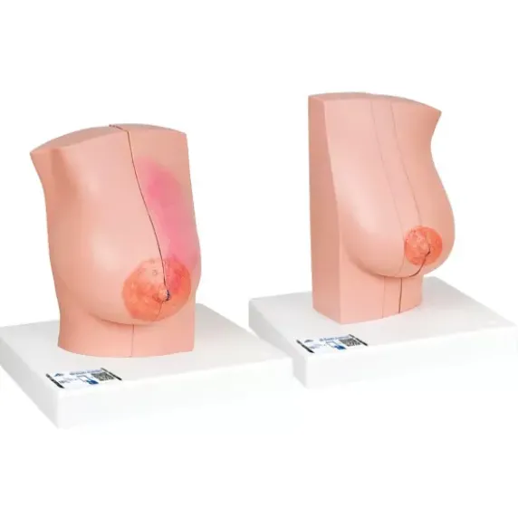MODÈLE DE POITRINE FÉMININE COUPES ANATOMIQUES 3B SCIENTIFIC - modèle pédagogique