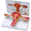 MODÈLE UTERUS ET OVAIRE SUR SOCLE GRANDEUR NATURE 3B SCIENTIFIC - sur socle