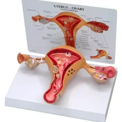 MODÈLE UTERUS ET OVAIRE SUR SOCLE GRANDEUR NATURE 3B SCIENTIFIC - sur socle