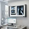 NÉGATOSCOPE LED EXTRA-PLAT 2 PLAGES LECTURE RADIOGRAPHIE CE - format 100 x 64 cm