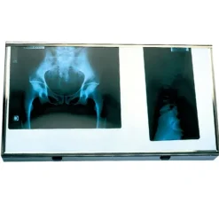 NÉGATOSCOPE 2 PLAGES VISUALISATION RADIO CE - 700 x 425 mm