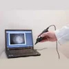 OTOSCOPE DIGITAL FIREFLY DE500 CONNECTÉ USB SPENGLER - filaire