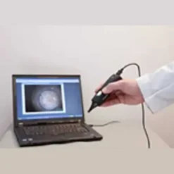 OTOSCOPE DIGITAL FIREFLY DE500 CONNECTÉ USB SPENGLER - filaire