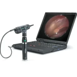 OTOSCOPE MACROVIEW DIGITAL
