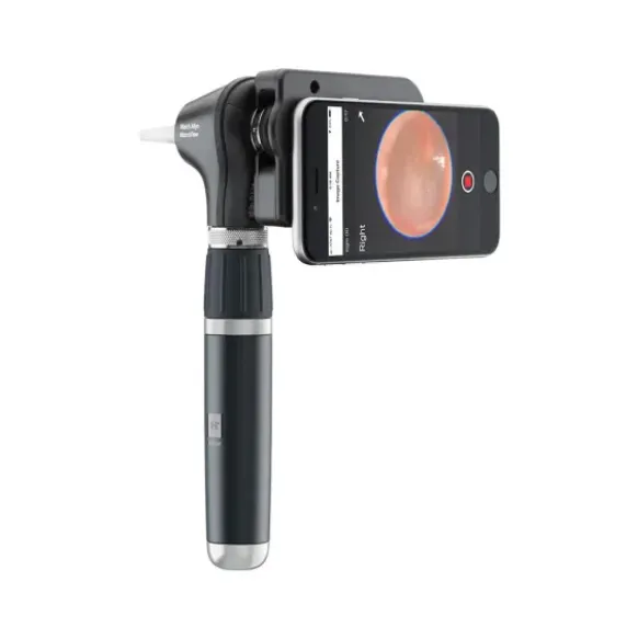 OTOSCOPE MACROVIEW 2 PLUS IEXAMINER LED WELCH ALLYN - avec accessoires