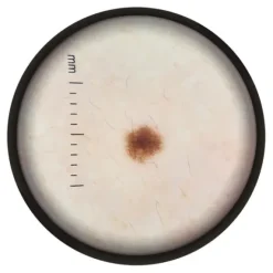 PACK LAMPE DE WOOD + DERMATOSCOPE DERMA MED30 NOIR - pack complet