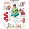 PLANCHES ANATOMIQUES HYPERTENSION FORMAT POSTER 3B SCIENTIFIC - 50 x 67 cm