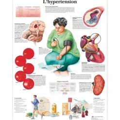 PLANCHES ANATOMIQUES HYPERTENSION FORMAT POSTER 3B SCIENTIFIC - 50 x 67 cm