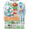 PLANCHES ANATOMIQUES LE DIABETE FORMAT MURAL 3B SCIENTIFIC - 50 x 67 cm