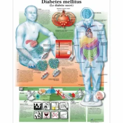 PLANCHES ANATOMIQUES LE DIABETE FORMAT MURAL 3B SCIENTIFIC - 50 x 67 cm