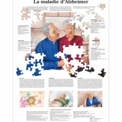 PLANCHES ANATOMIQUES MALADIE D'ALZHEIMER PLASTIFIÉES 3B SCIENTIFIC - format 50 x 67 cm