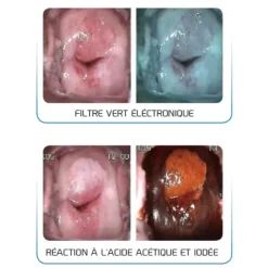 VIDÉO COLPOSCOPE C6A + PIED + BRAS ARTICULE + PLATEAU