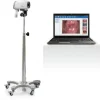 VIDÉO COLPOSCOPE C6A SUR PIED À ROULETTES STANDARD EDAN - version standard